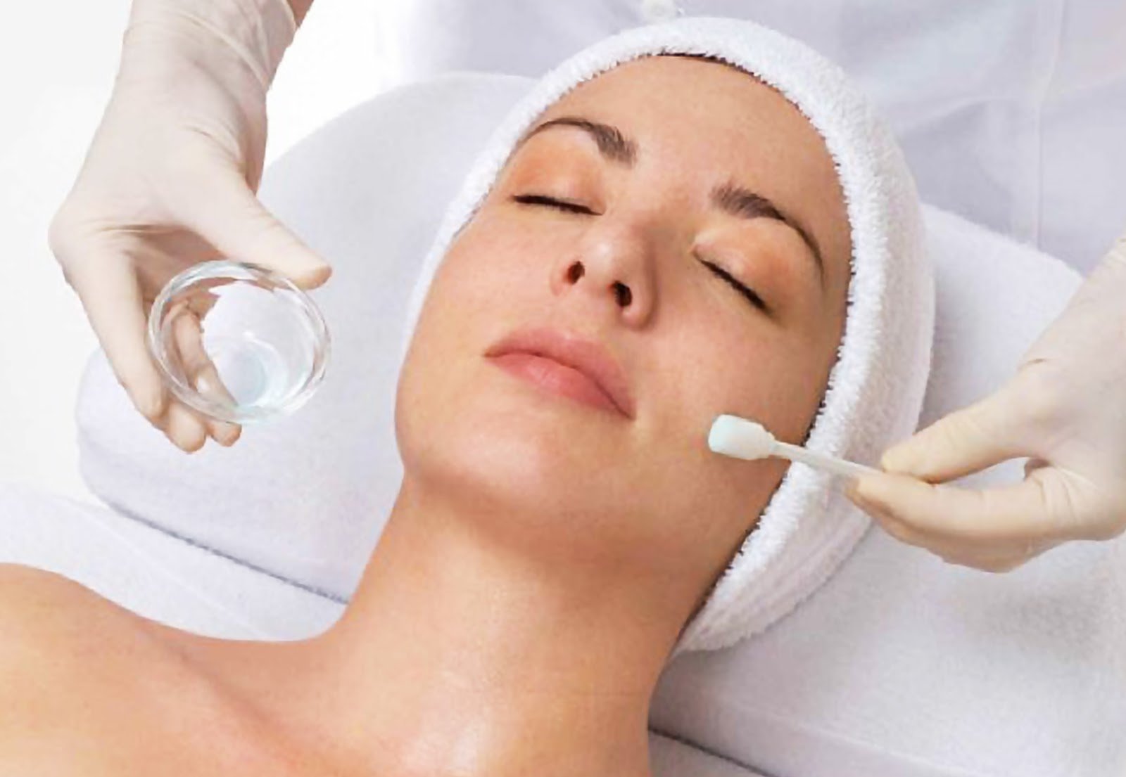 Chemical Peel Treatment