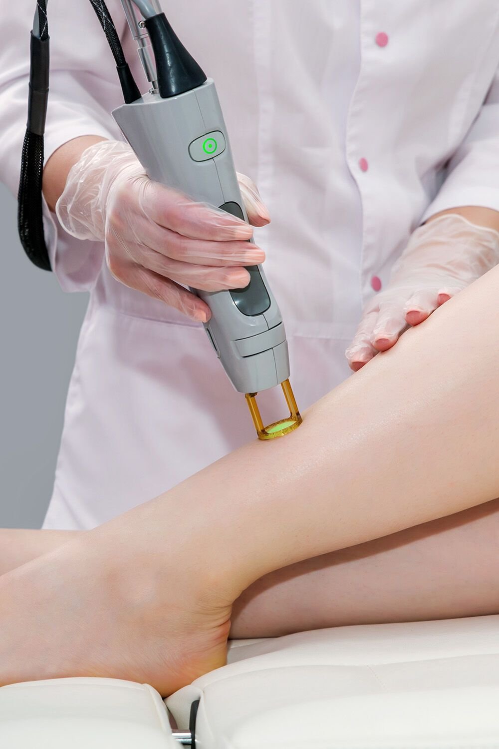 Laser Treatment